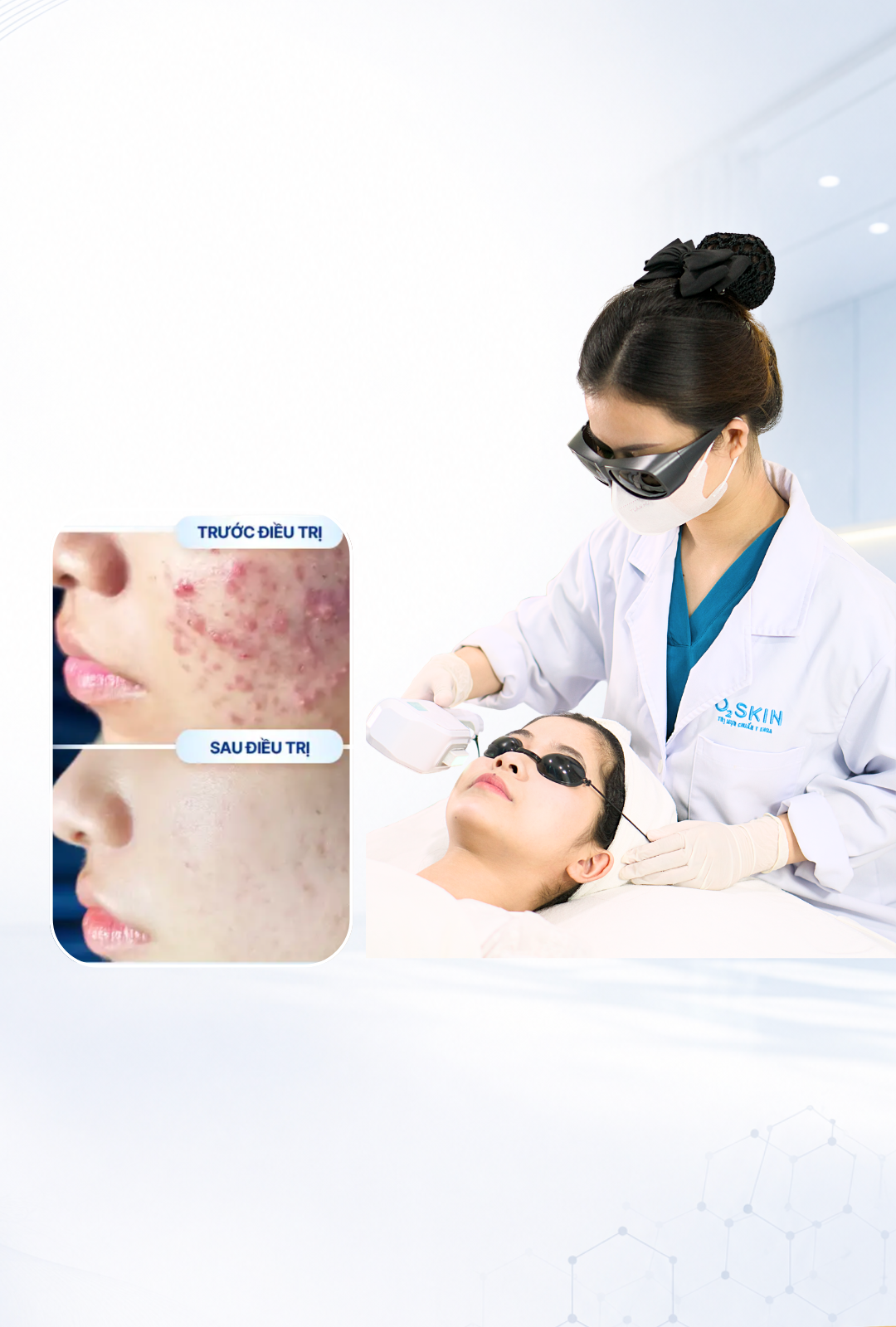 O2 SKIN IPL