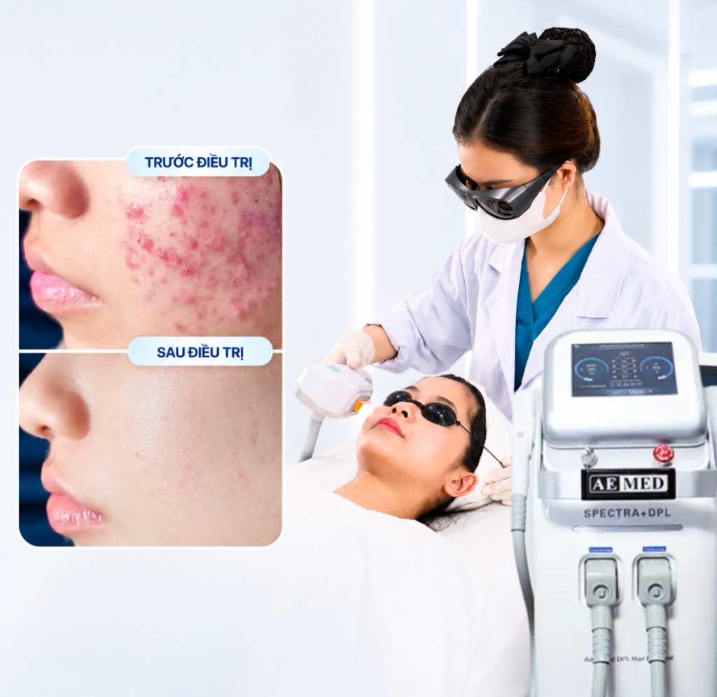 O2 SKIN IPL
