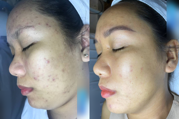 Khách hàng Trần Thị Thùy Dung